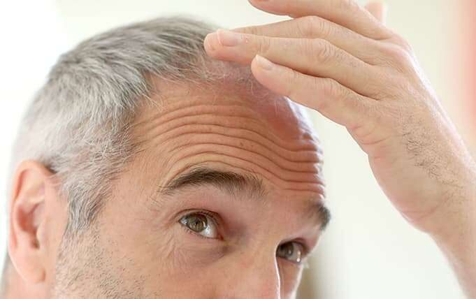 Aging Hair Loss treatment in Lahore Pakistan